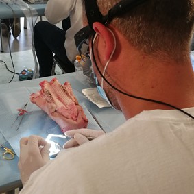 Chirurgie Plastique Muco Gingivale Implantaire